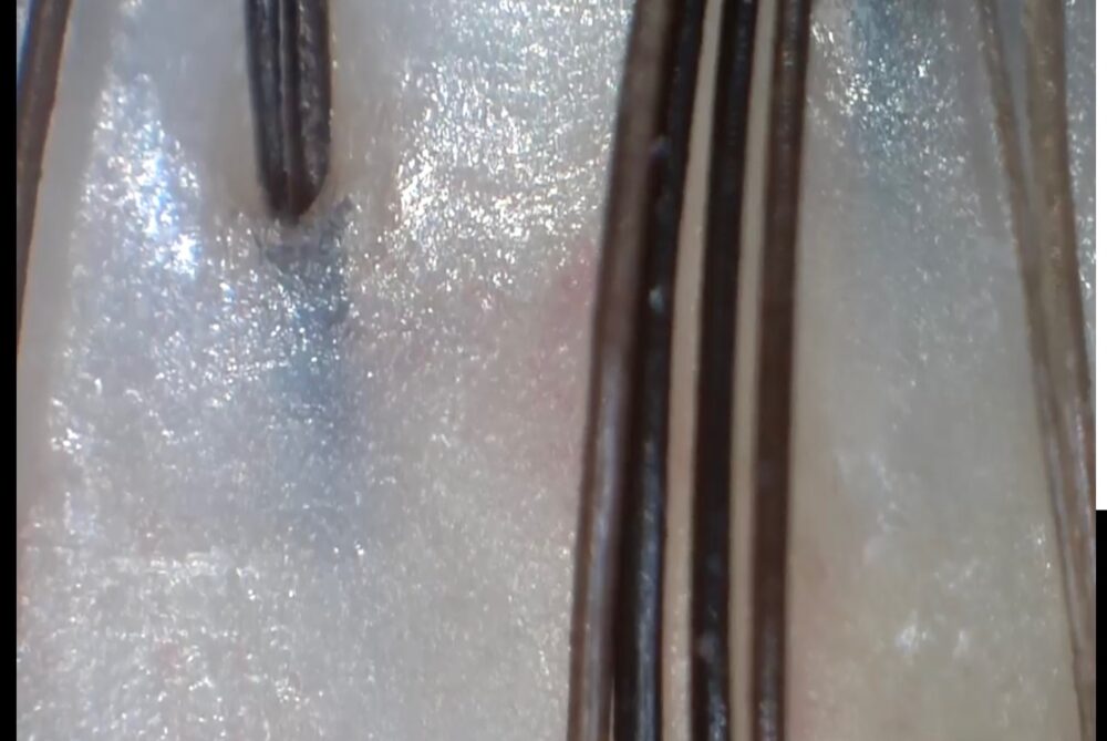 シルキースムースで洗った頭皮状態のマイクロスコープ画像