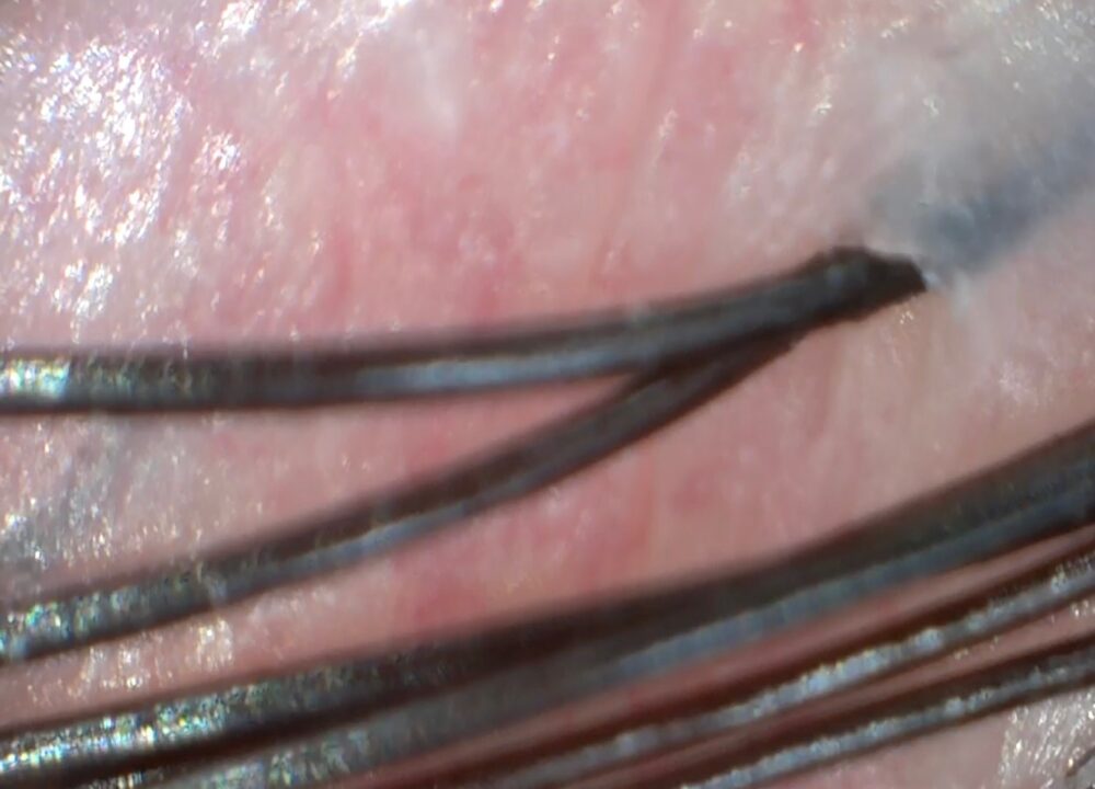 クリーミーEXダメージリペアで洗った頭皮状態のマイクロスコープ画像